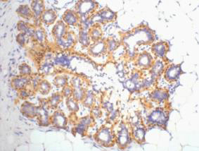 β-actin Polyclonal Antibody