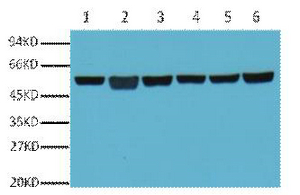 β-Tubulin Monoclonal Antibody