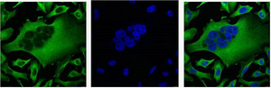 β-Tubulin Monoclonal Antibody