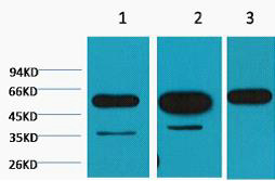 β-tubulin(HRP Conjugated) Monoclonal antibody