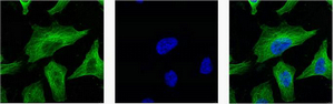 β-Tubulin Monoclonal Antibody