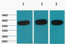 β-Tubulin Monoclonal Antibody