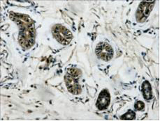 β-Tubulin Monoclonal Antibody