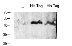His-tag Polyclonal Antibody