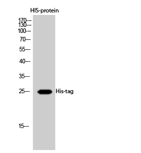 His-tag Polyclonal Antibody
